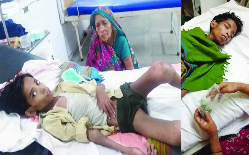 दर्दनाक: कुछ ऐसी है वाराणसी के 'विकास' की दुनिया, न इलाज के हैं पैसे और ना ही कोई सहारा