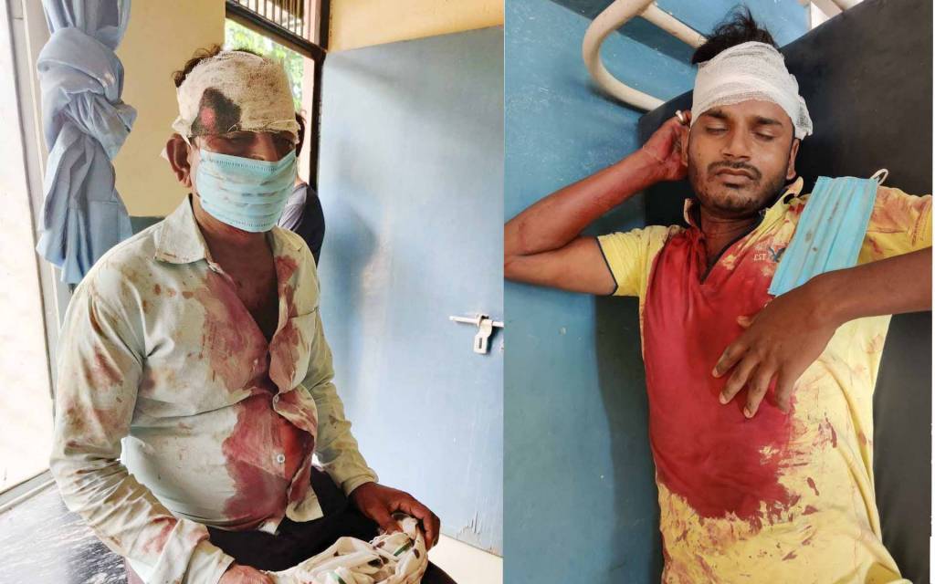 वाराणसी: जमीनी विवाद में दो पक्षों में खूनी संघर्ष, ग्राम प्रधान सहित दर्जनभर हुए घायल
