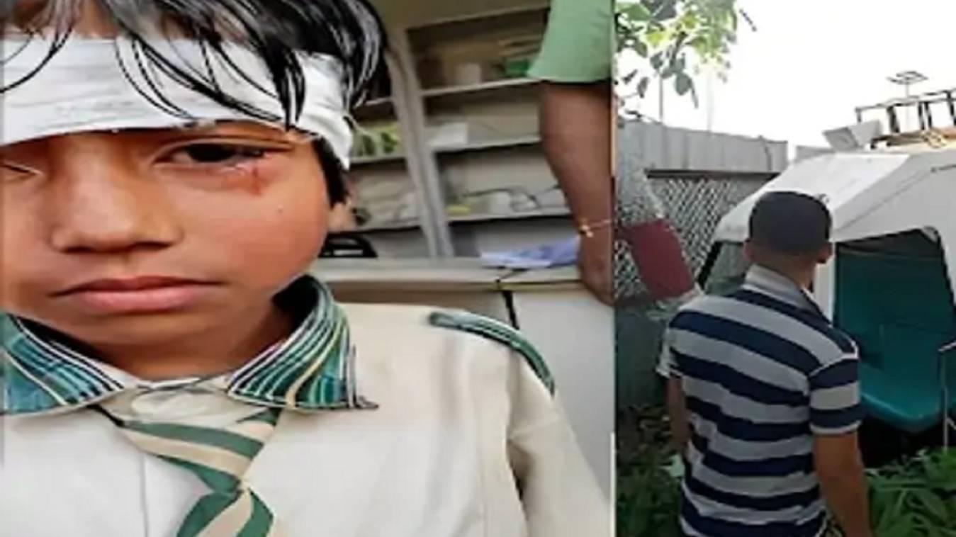 varanasi : बच्चों से भरी ऑटो पेड़ से टकराई, कई बच्चे घायल, मौके से भागा चालक