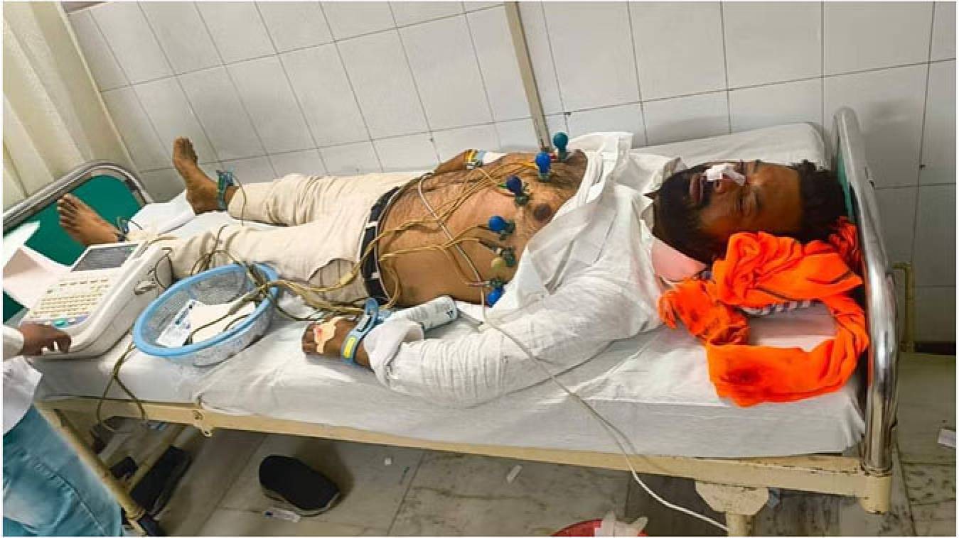 चुनाव प्रचार के दौरान बंधे से नीचे गिरे भाजपा नेता, घायल-  हालत गंभीर