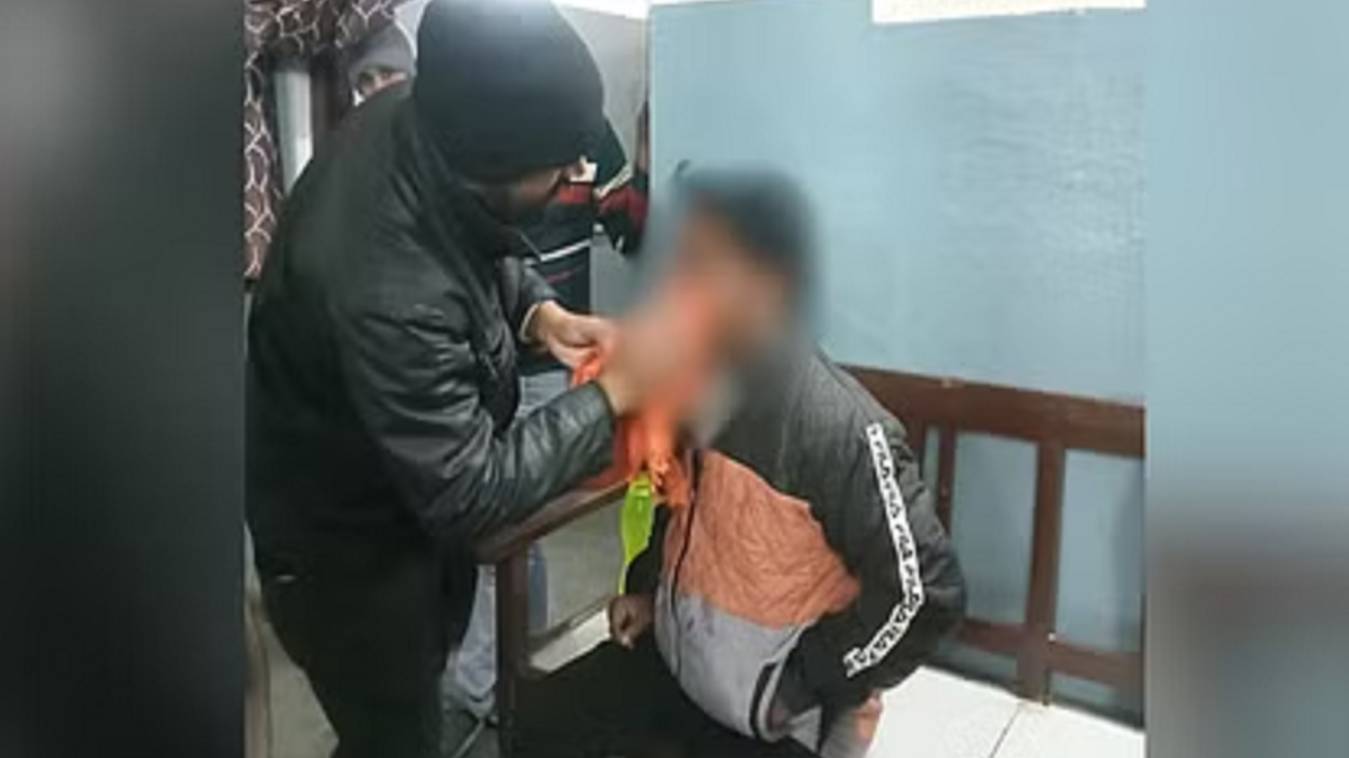 चाइनीज मांझे से विश्वनाथ मंदिर के गार्ड सहित तीन युवक घायल, एक को लगे 20 टांके