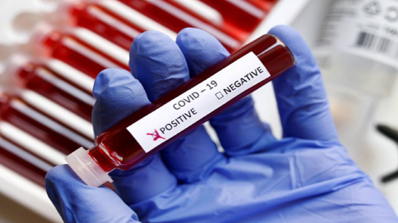 वाराणसी में कोरोना ने पकड़ी रफ़्तार, आज फिर मिले कोरोना के 2 नए मरीज, मची खलबली