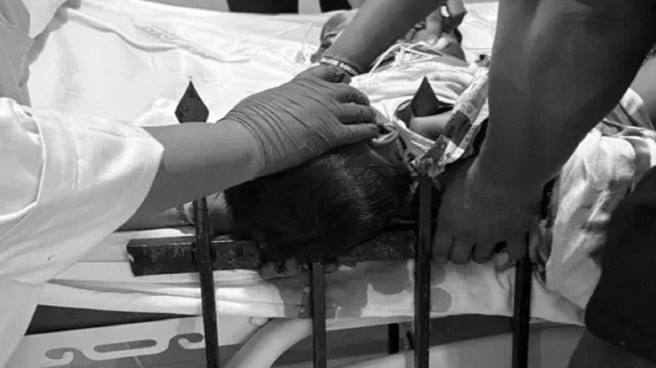 लखनऊ में 3 साल के बच्चे के सिर -कंधे के आर-पार हुई ग्रिल, KGMU के ट्रॉमा सेंटर में हुई सफल सर्जरी