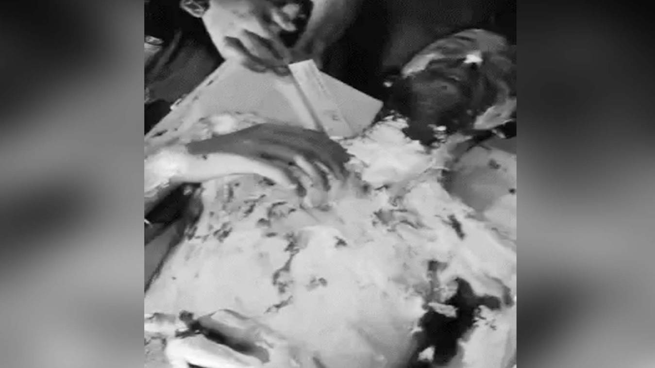 मुजफ्फरनगर: DAV कॉलेज में छात्र ने फीस विवाद के चलते आत्मदाह किया, हालत नाजुक