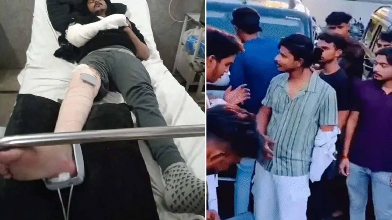 20 लाख की फिरौती में अपहरण, पुलिस से बचने में छत से कूदा बदमाश; अस्पताल में भर्ती