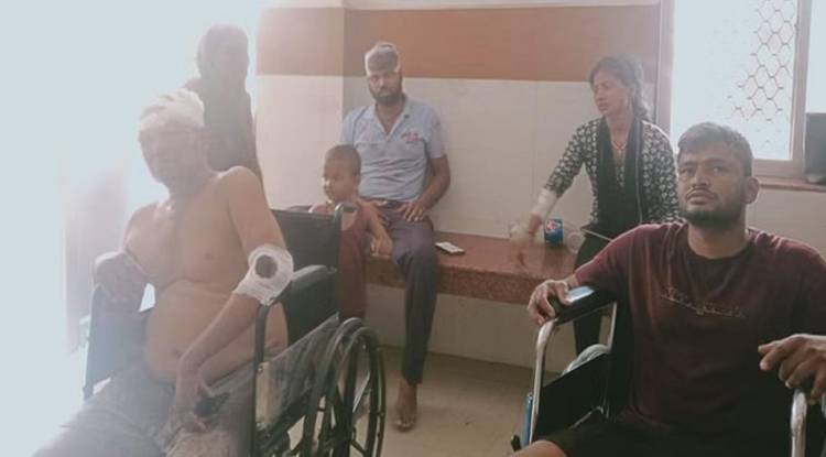 मोटरसाइकिल हटाने के विवाद में जमकर चले लाठी डंडे, किसी फूटा सिर तो किसी के टूटे हाथ 