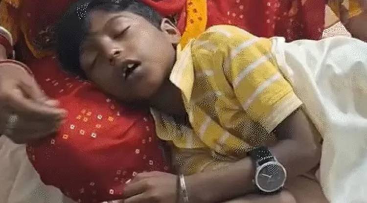 वाराणसी: स्कूल में 7 साल के बच्चे पर गिरी खौलती दाल, 30% झुलसा, टीचर बोलीं -'घर में जलता तो क्या करती, अब जाओ इलाज कराओ'