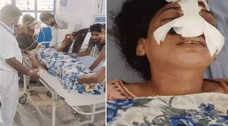 मुरादाबाद में पति ने पत्नी की नाक काटी, मायके से बात करने पर था विवाद