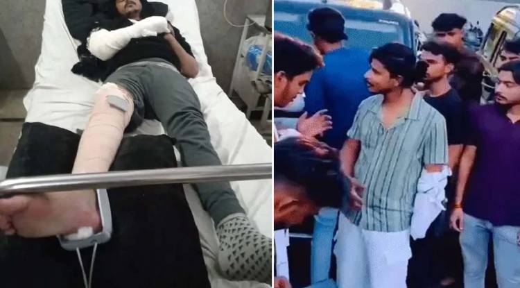 20 लाख की फिरौती में अपहरण, पुलिस से बचने में छत से कूदा बदमाश; अस्पताल में भर्ती