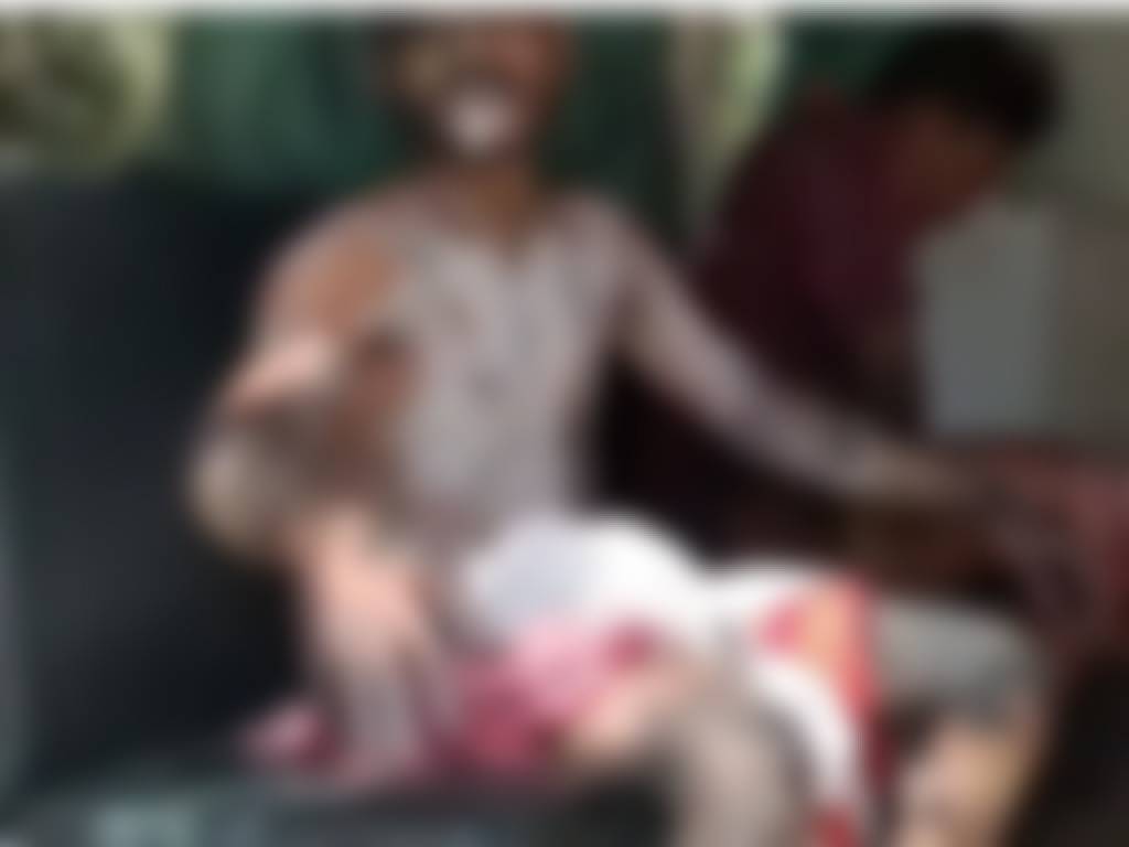 एसिड गिरने से तीन युवक झुलसे, डिग्गी में रखा था केमिकल