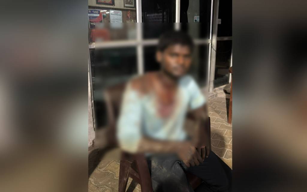 वाराणसी में प्रेम संबंध के शक में युवक पर कुल्हाड़ी से किया वार, हालत गंभीर,  FIR