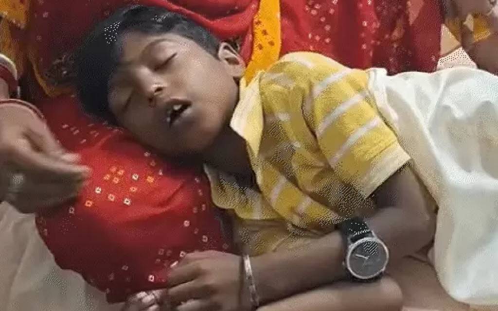 वाराणसी: स्कूल में 7 साल के बच्चे पर गिरी खौलती दाल, 30% झुलसा, टीचर बोलीं -'घर में जलता तो क्या करती, अब जाओ इलाज कराओ'
