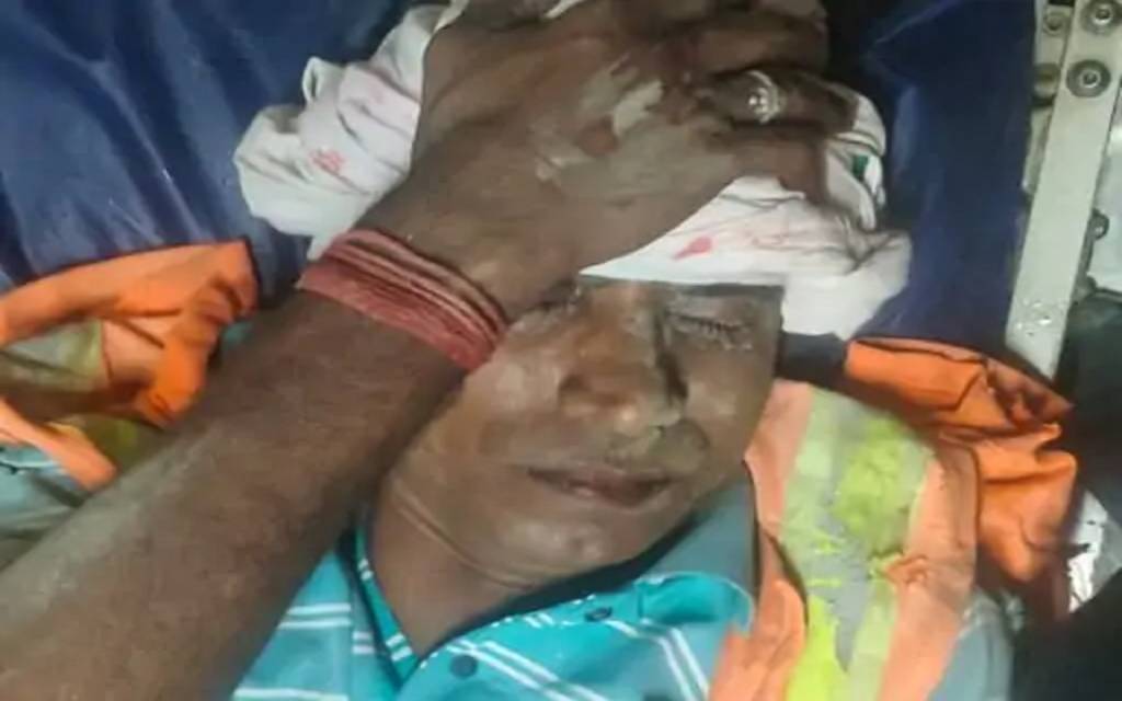 वाराणसी: सड़क हादसे में नगर निगम कर्मचारी गंभीर रूप से घायल, ड्यूटी से लौटते समय अज्ञात वाहन ने मारी टक्कर