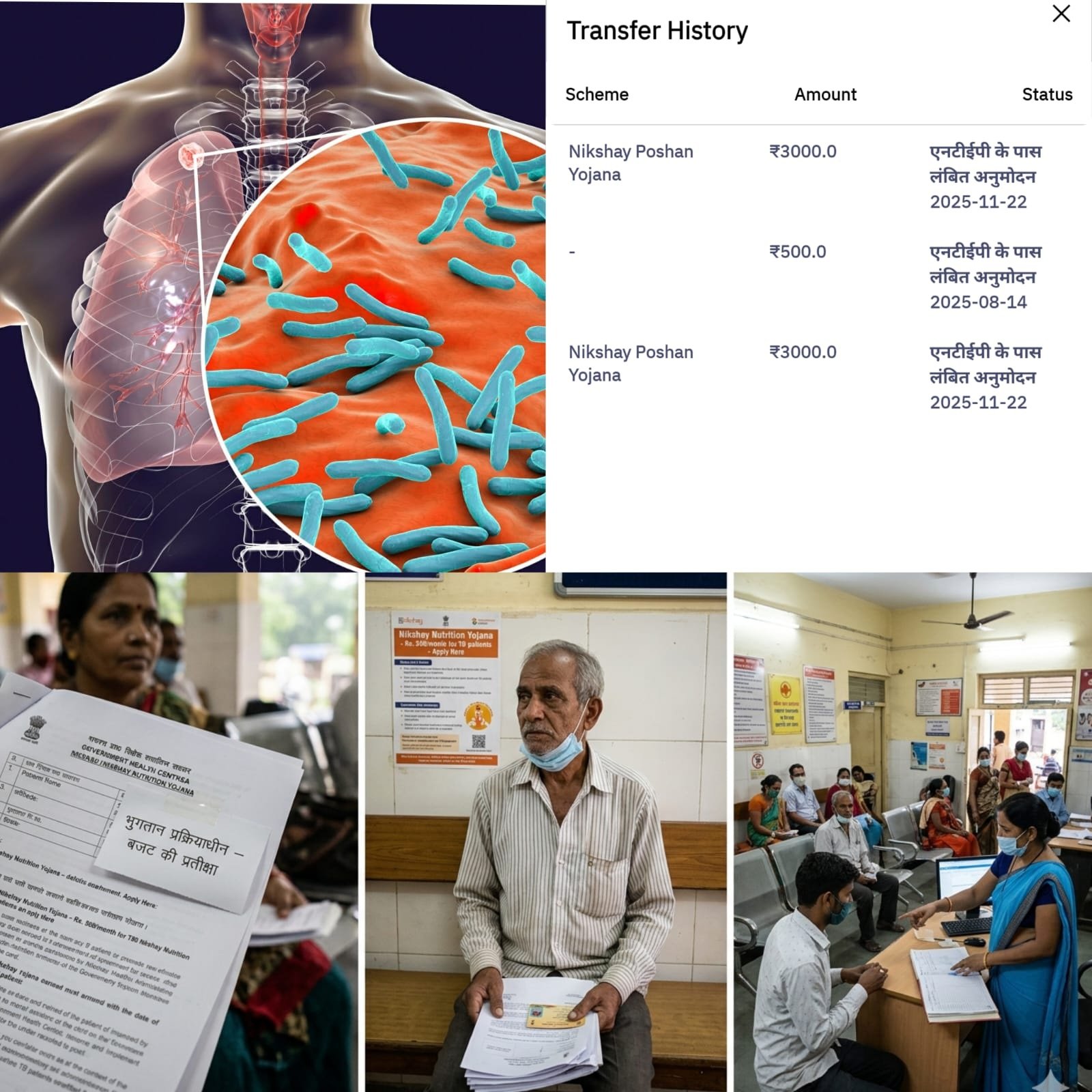 बजट के अभाव में दम तोड़ रही निक्षय पोषण योजना