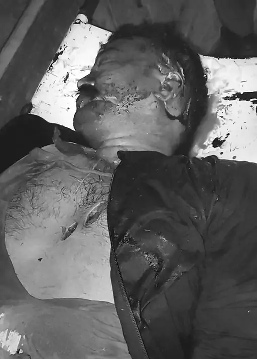 गोरखपुर में भाजपा नेता की निर्मम हत्या: मॉर्निंग वॉक पर घेरकर 25 वार, मौत की तसल्ली के बाद भागे हमलावर