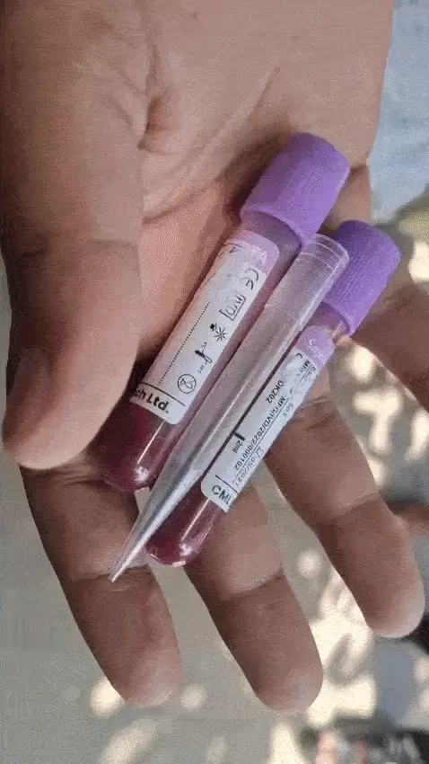 यूपी कॉलेज में छात्र की हत्या मामले को लेकर छात्रों का बढ़ा आक्रोश, मुख्यमंत्री को खून से लिखा पत्र