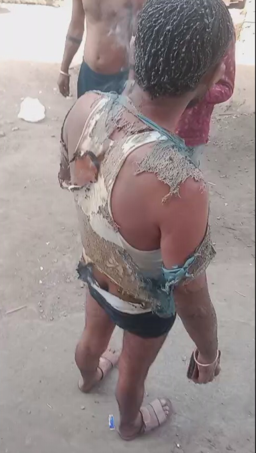 वाराणसी में गैस सिलेंडर धमाका, मकान का ऊपरी हिस्सा क्षतिग्रस्त, एक व्यक्ति झुलसा