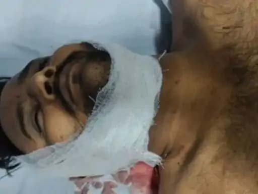 हापुड़ में प्रॉपर्टी डीलर की गोली मारकर हत्या: शादी से लौटते वक्त कार रोककर बरसाईं गोलियां, भाजपा नेता समेत 8 पर केस