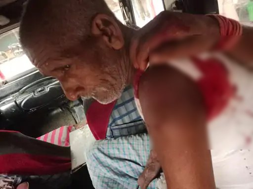 किराने के सामान की कीमत पर विवाद, 75 वर्षीय दुकानदार पर फायरिंग: गोली बांह चीरते हुए निकली, आरोपी फरार