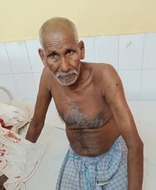 किराने के सामान की कीमत पर विवाद, 75 वर्षीय दुकानदार पर फायरिंग: गोली बांह चीरते हुए निकली, आरोपी फरार