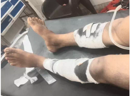 कौशांबी में प्रेमिका से मिलने पहुंचे युवक की पीट-पीटकर हत्या, किशोरी गंभीर घायल
