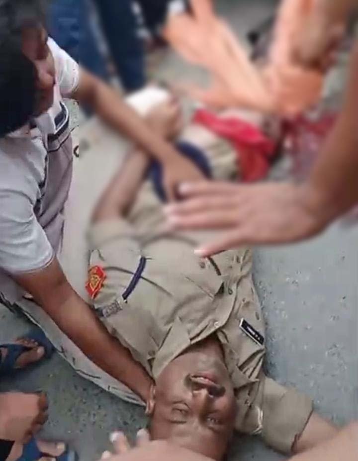 तेज रफ्तार ट्रक की टक्कर से CRPF जवान घायल, गंभीर हालत में BHU ट्रॉमा सेंटर रेफर