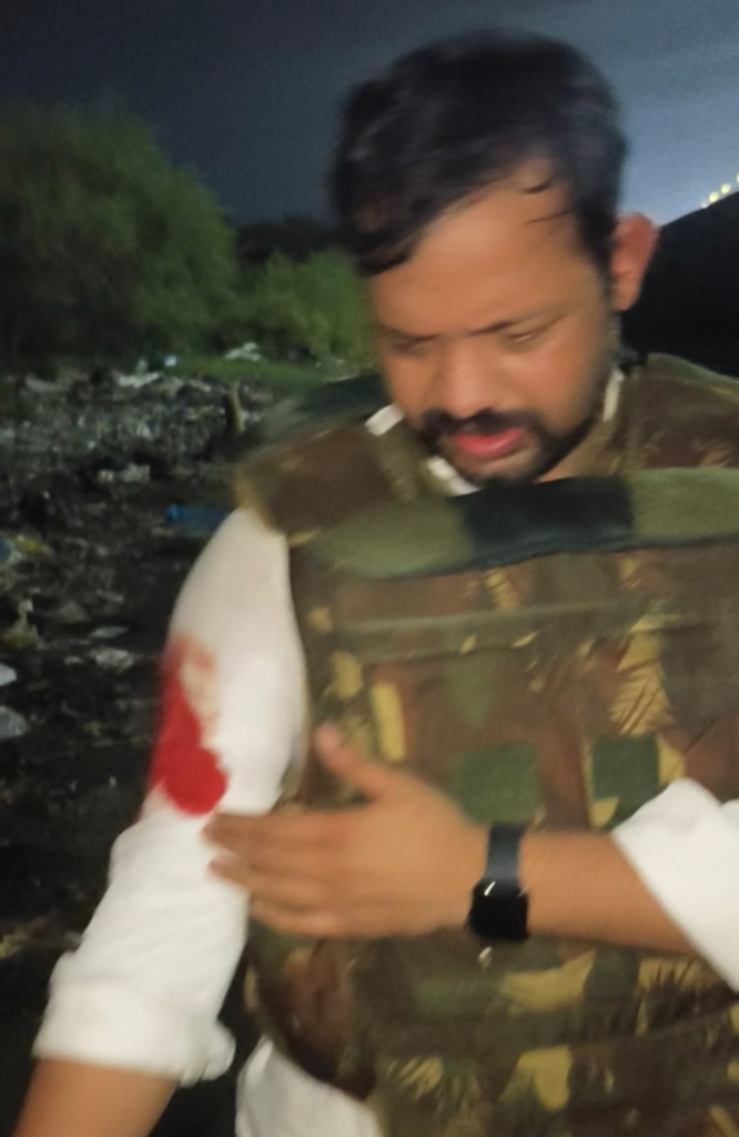 वाराणसी में पुलिस-बदमाश मुठभेड़ : 27 किलो चांदी लूटकांड के दो आरोपी घायल, एसओजी प्रभारी भी हुए जख्मी