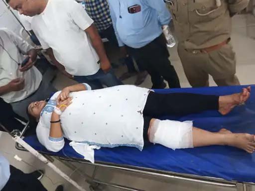 वाराणसी के SBI बैंक में अचानक चली गोली, महिला कर्मचारी घायल; रिवॉल्वर गिरने से हुआ हादसा