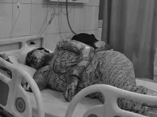 पटाखा विस्फोट में झुलसी चांदनी बेगम की मौत, 12 साल के बेटे के दोनों हाथ टूटे, अस्पताल में चल रहा इलाज