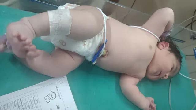 वाराणसी: कबीरचौरा अस्पताल में गूंजी किलकारी, 4 किलो 530 ग्राम के नवजात का हुआ जन्म