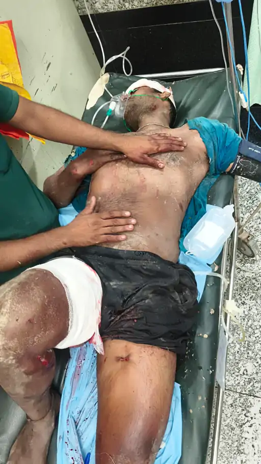 वाराणसी में बेकाबू हुआ रामलीला का हाथी, सड़क पर मचाया तांडव; महावत को पटककर किया घायल