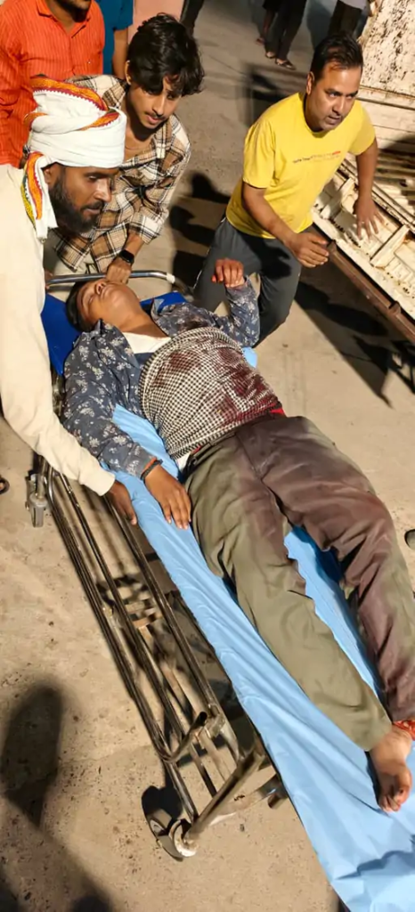 वाराणसी: पेंशन और जमीन के पैसों के विवाद में चाकूबाजी, बड़े भाई समेत परिवार के 4 लोग घायल; तीन की हालत गंभीर